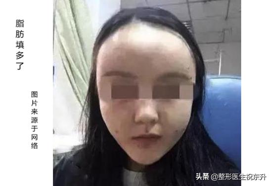 填充脂有什么作用和功效(图9)