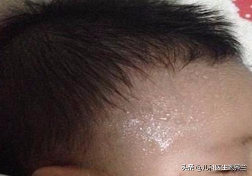 宝宝睡前出汗怎么改善(图4)