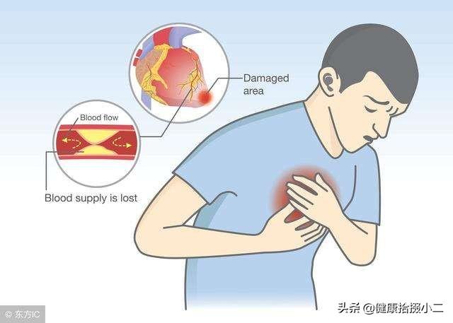 心肌为什么会缺血，心肌为什么会缺血怎么治疗