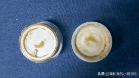 鼻炎是怎么形成的(图6)