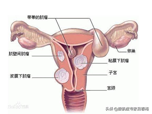 请问肌病是一种什么病?(肌病怎么治疗)
