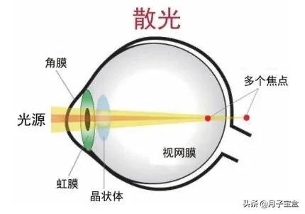 儿童怎么改善眼睛闪光(图2)