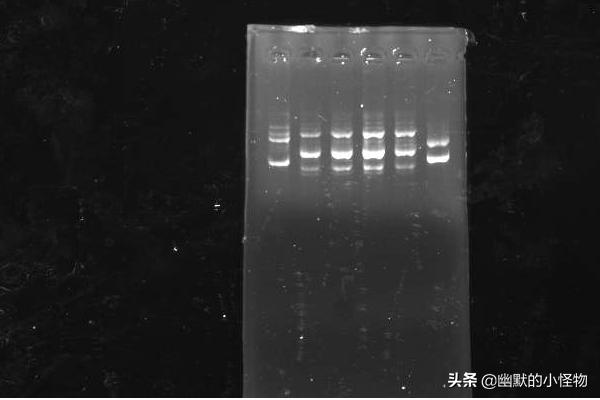 我们能看见两条电泳带,一般的质粒在跑完电泳之后都会出现这种情况