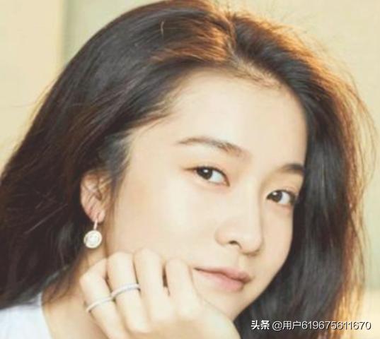 刘海中间秃了怎么改善(图4)