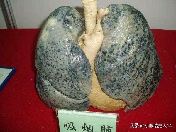 男人如何搭配衣服显年轻(图10)