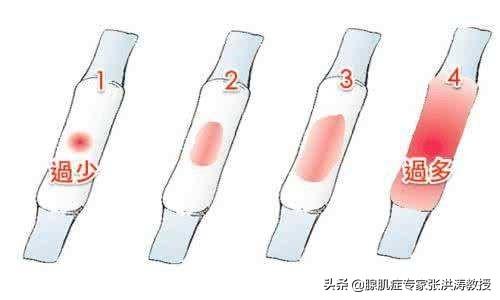 大姨妈来的量多怎么回事(图4)