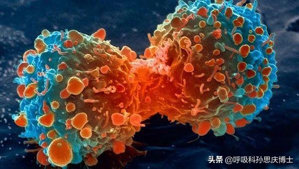 肺上有小结节怎么治疗