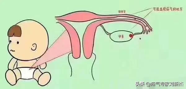 疝气是什么病怎么引起的原因