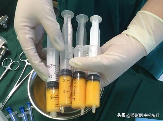 填充脂有什么作用和功效(图7)