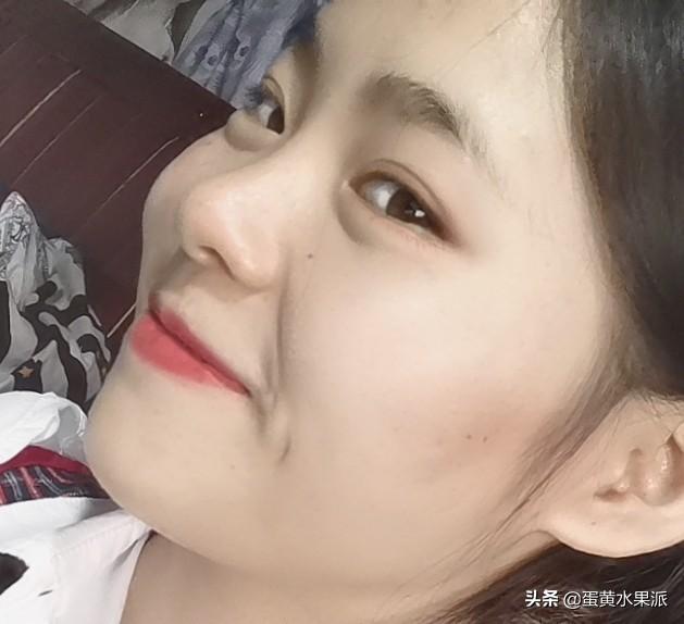 脸上长痘痘怎么去掉痘痘(图15)