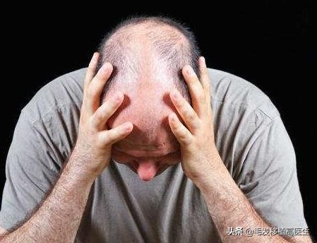 女人掉头发是什么原因(图4)