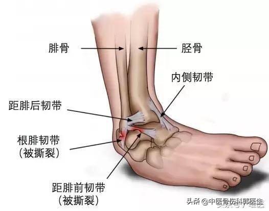 预防运动损伤小常识（常见的运动损伤及处理方式？）