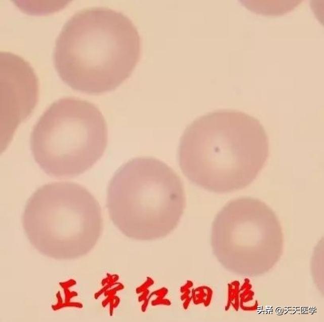 儿童贫血怎么调理比较好(图1)