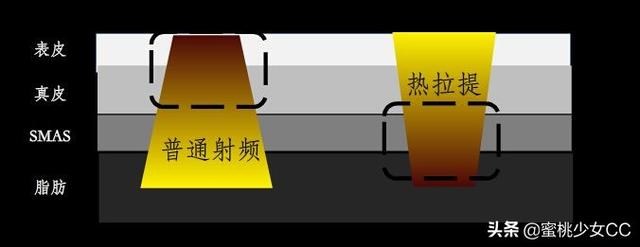 脸部怎么保养衰老慢(图16)