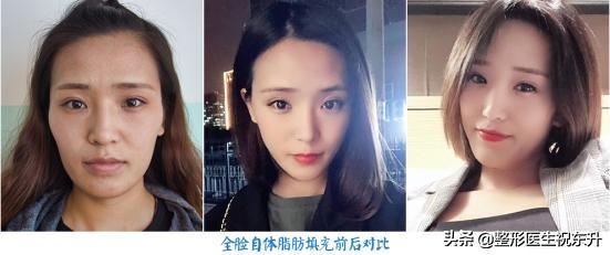 填充脂有什么作用和功效(图8)