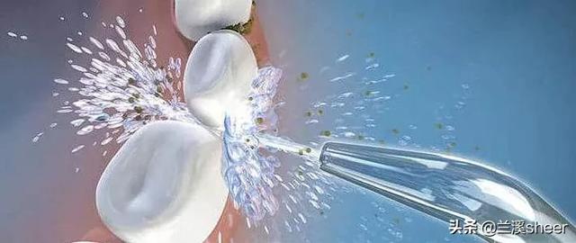 冲牙器坏了哪里可以维修？